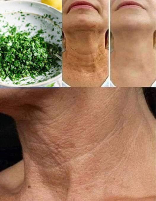 This Natural Mask Helps Reduce Wrinkles and Dark Spots 👇