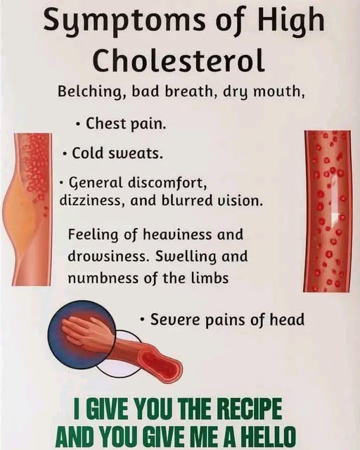 Symptoms of High Cholesterol You Should Not Ignore