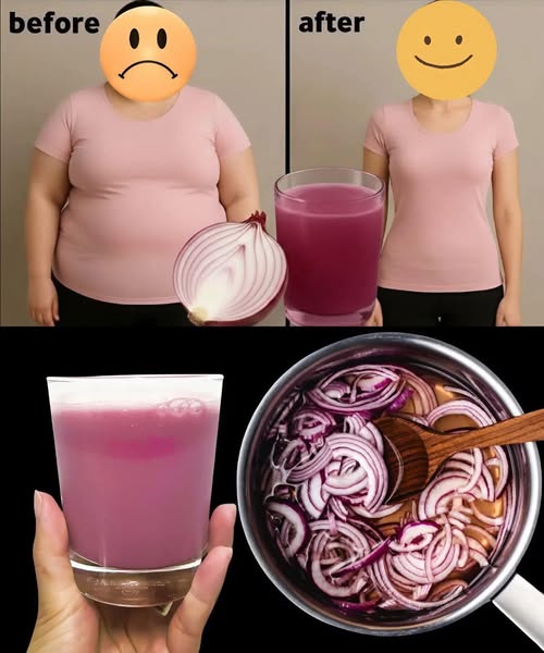 The Incredible Purple Onion Drink That Helps Burn Belly Fat Naturally 🌿🧅