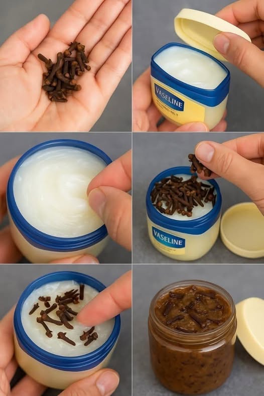 Mix Cloves With Vaseline: