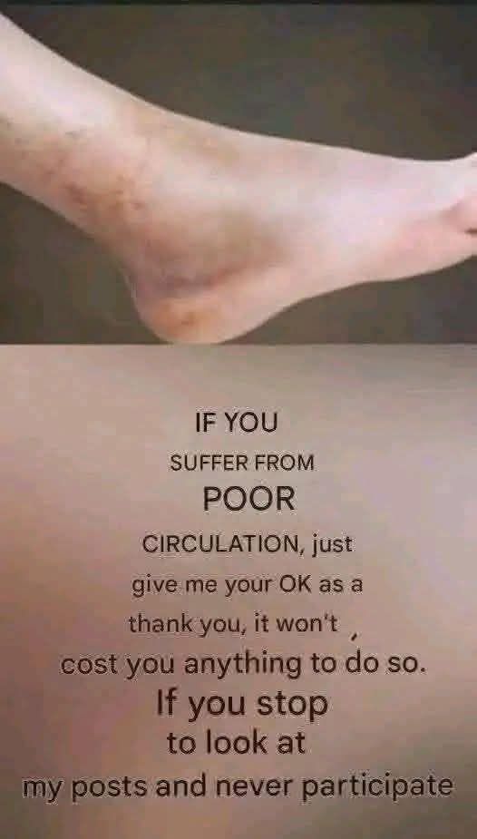 If You Suffer From Poor Circulation and Your Legs Look Like This, Here’s What Can Help 🌿🦵