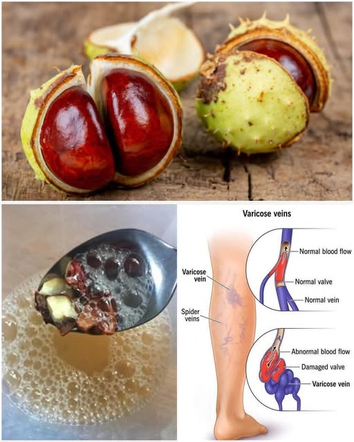 Say Goodbye to Varicose Veins, Hemorrhoids, Swollen Feet, Joint & Muscle Pain 🌿