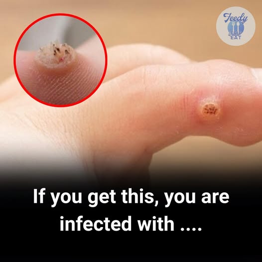 IF YOU GET THIS , YOU ARE INFECTED WITH……