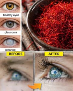 How To Improve Your Vision Naturally With One&hellip;