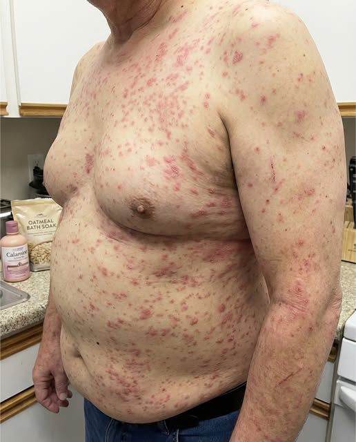 Why Your Body Feels Itchy: Common Causes You Should Know 