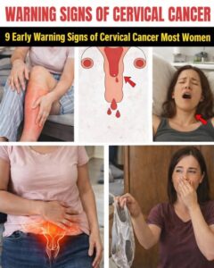 9 Early Warning Signs of Cervical Cancer Most&hellip;