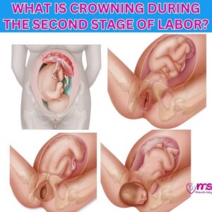 What Every Pregnant Woman Should Know About Crowning 