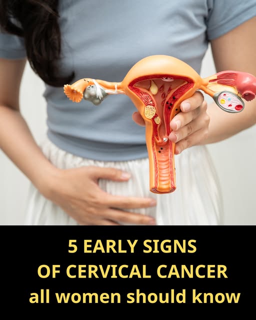 5 EARLY SIGNS OF CERVICAL CANCER All Women Should Know