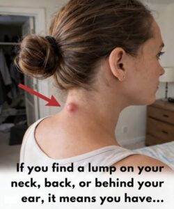 If You Find a Lump on Your Neck,&hellip;