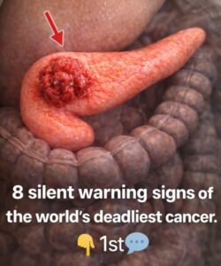 8 Silent Warning Signs of One of the&hellip;