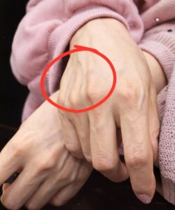 If You Have Visible Veins, It Means You&hellip;