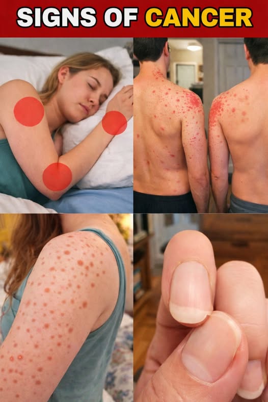 10 Common and Overlooked Signs of CANCER! Watch Before It’s Too Late
