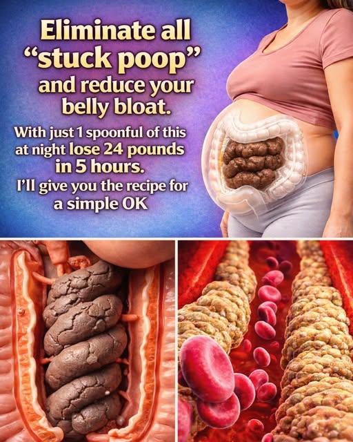 Bloated Stomach and Constipation? This Natural Recipe Can Help Reduce Bloating and Support Healthy Digestion