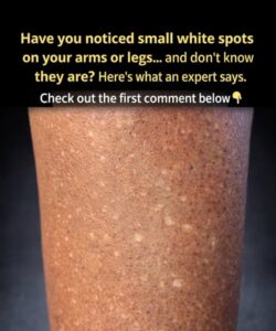 Have you noticed small white spots on your&hellip;