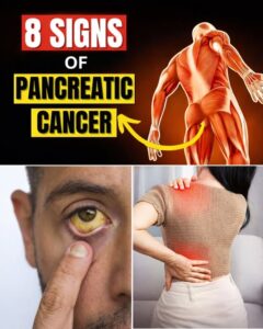 8 Shocking Symptoms of Pancreatic Cancer You Should&hellip;