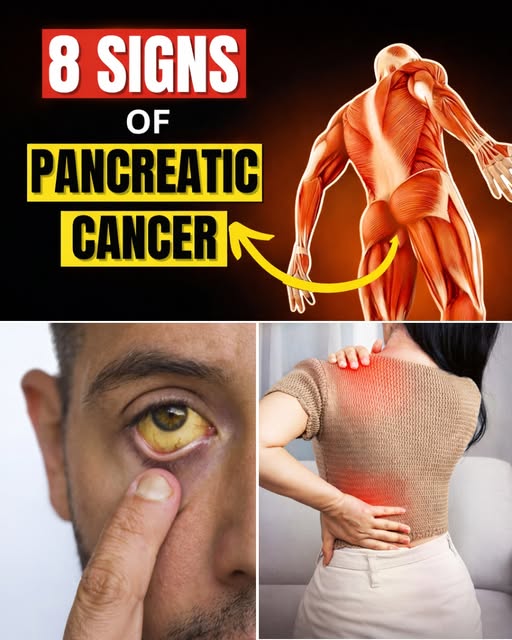 8 Shocking Symptoms of Pancreatic Cancer You Should NEVER Ignore 