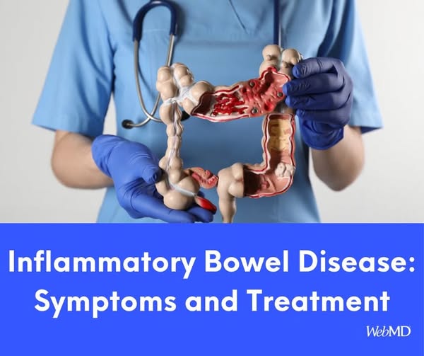 inflamentry bowel disease , symptoms and treatment