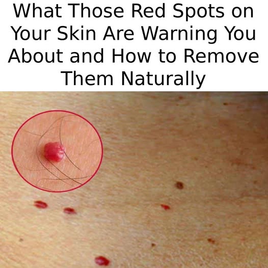 what those red spots on your skin are warning you about and how to remove them naturally .