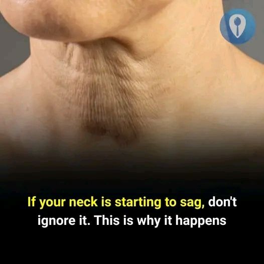 If the Skin on Your Neck Is Starting to Loosen, Here’s Why It Happens
