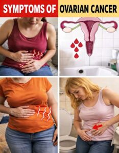 6 WARNING Symptoms of Ovarian Cancer Every Woman&hellip;