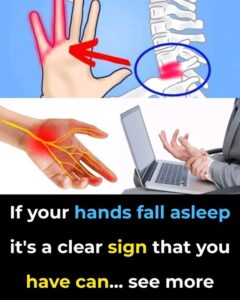 If Your HANDS Fall Asleep, Is It a&hellip;