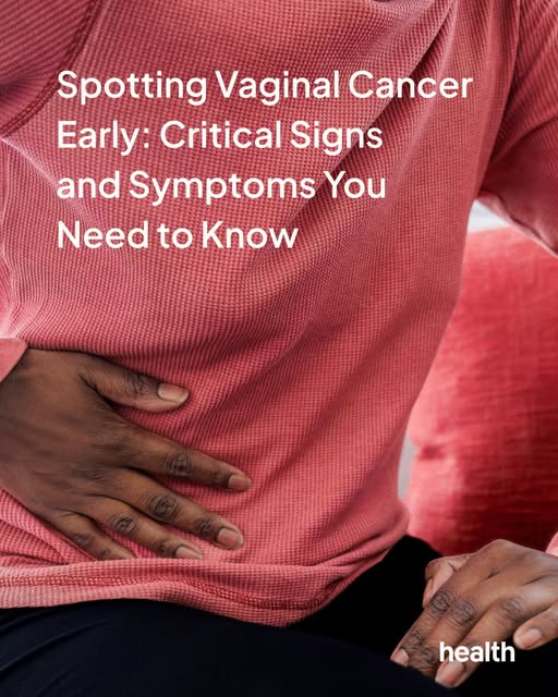 Vaginal cancer is rare, and unfortunately, the symptoms of this cancer are hard to spot in the early stages.