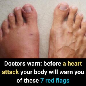 Doctors Warn: Before a Heart Attack, Your Body&hellip;