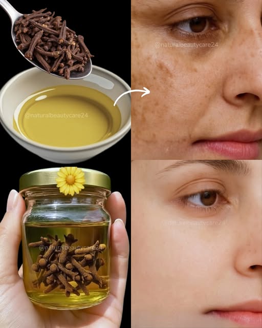## You’ll Never Need Makeup to Hide Dark Spots? Here’s the Truth About Glowing Skin 
