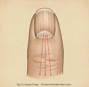  “If You Have Lines on Your Nails, It&hellip;