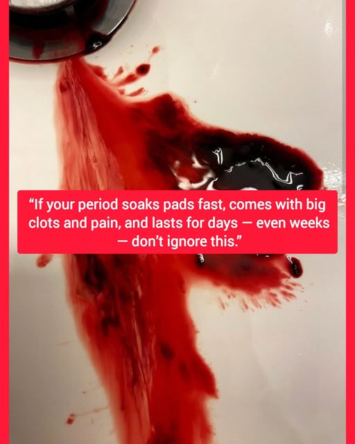 “If your period soaks pads fast, comes with big clots and pain, and lasts for days — even weeks — don’t ignore this.” 