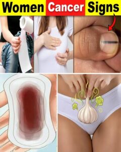  14 Visible Signs Of Cancer Most Women Ignore