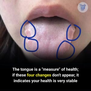  Your Tongue Is a Window to Your Health:&hellip;