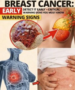  10 Warning Signs and Symptoms of Breast Cancer&hellip;