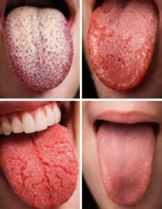  If You Have THIS on Your Tongue… It&hellip;