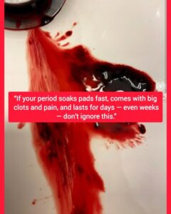  If Your Period Soaks Pads Quickly, Has Large&hellip;
