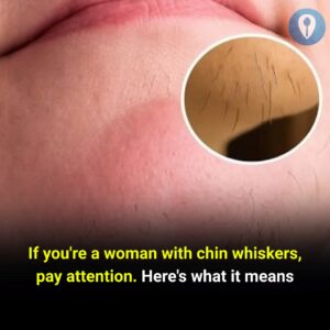 If You’re a Woman with Chin Whiskers, Pay&hellip;