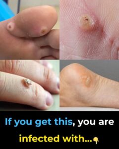 If You Get This, You Could Be Infected&hellip;