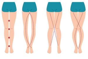 THE LEGS OF A WOMAN CAN SAY AS&hellip;