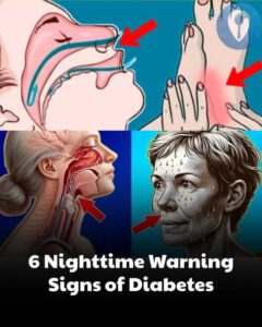  6 Night-Time Warning Signs of Dia.betes You Shouldn’t&hellip;
