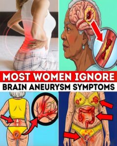  WOMEN OVER 60: 10 Brain Aneurysm Early Symptoms&hellip;