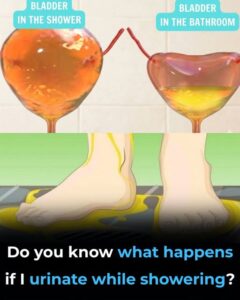  If You Urinate in the Shower, Be Careful&hellip;
