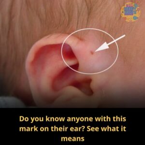 Do You Know Anyone With This Mark on&hellip;