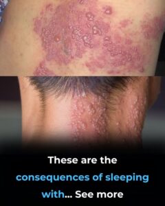  These Are the Consequences of Sleeping With Multiple&hellip;