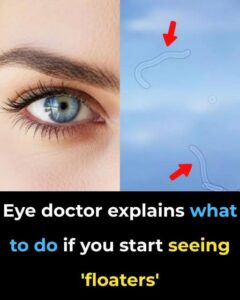  Eye Doctor Explains What To Do If You&hellip;