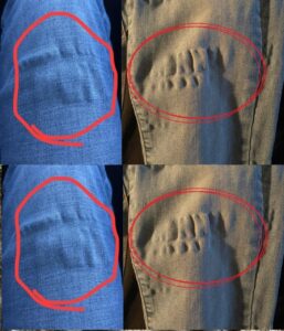  If You’ve Ever Seen These on Your Jeans,&hellip;